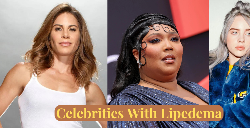 Celebrities with Lipedema